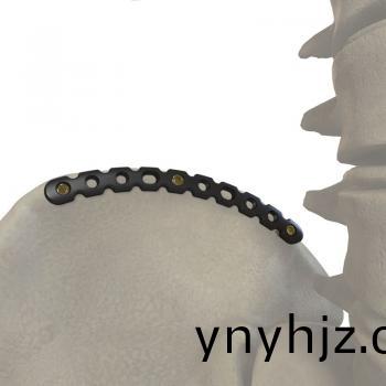 弧形(xing)重建鎖定接(jie)骨(gu)闆