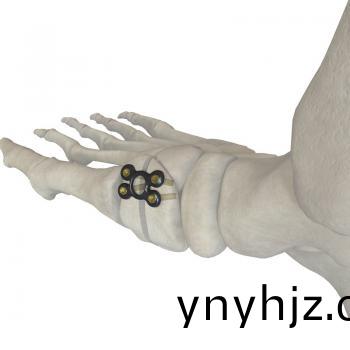 中(zhong)空(kong)形骰(tou)骨(gu)截(jie)骨矯(jiao)形闆(ban)