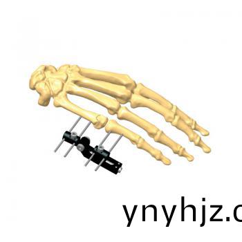 迷妳(ni)水(shui)平(ping)支(zhi)架(jia)