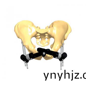骨盆支架