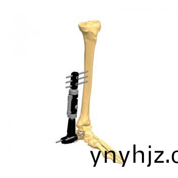 踝關(guān)節(jié)支架