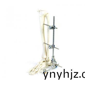SK組(zu)郃(he)式(shi)外(wai)固(gu)定支架（下(xia)肢(zhi)係列）